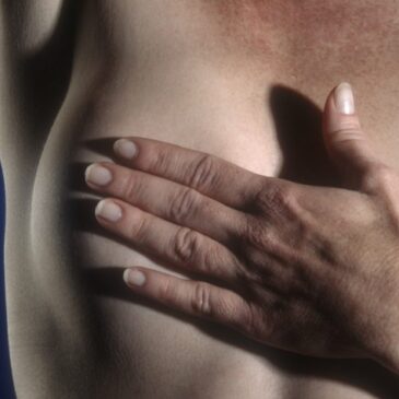 Mutirão para zerar fila de cirurgia de câncer de mama