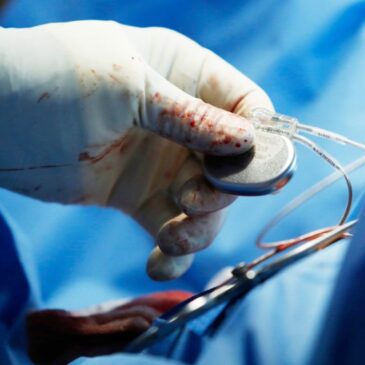 Zerada a fila de pacientes de marca-passo do Base