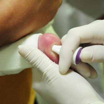 Teste do pezinho feito no DF é o mais completo do país